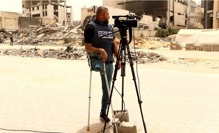 Palestinian journalist, Sami Shehada lost his leg in an attack in Gaza.