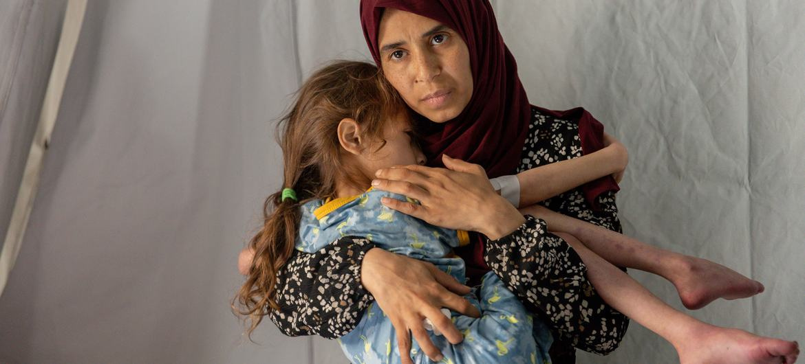 © OMS Un enfant de sept ans souffrant de malnutrition aiguë sévère et de déshydratation dans le sud de la bande de Gaza en avril.
